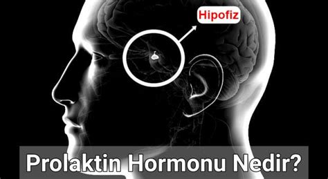 prolaktin hormonu neden yüksek çıkar